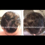 Dr. Stuti Khare Shukla Hair Growth Queen of India | drstutikhareshukla.com